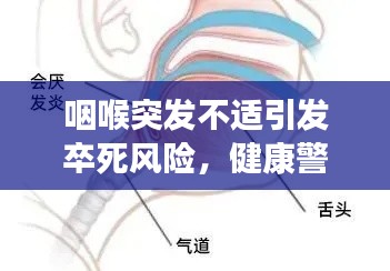 咽喉突發(fā)不適引發(fā)卒死風(fēng)險(xiǎn)，健康警鐘長(zhǎng)鳴！