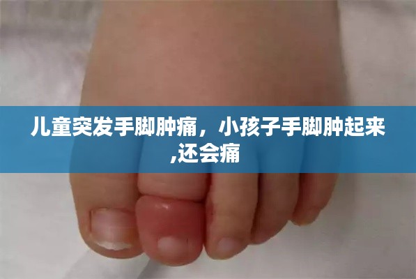 兒童突發(fā)手腳腫痛，小孩子手腳腫起來,還會痛 