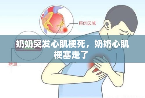 奶奶突發(fā)心肌梗死，奶奶心肌梗塞走了 