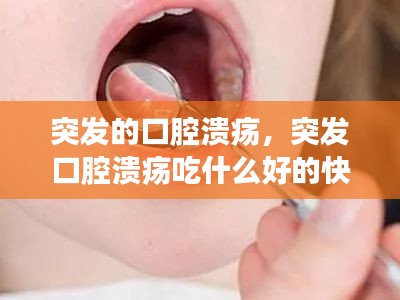 突發(fā)的口腔潰瘍，突發(fā)口腔潰瘍吃什么好的快 