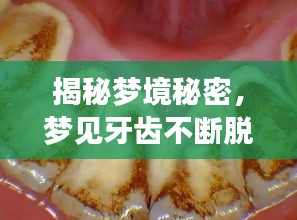 揭秘夢(mèng)境秘密，夢(mèng)見(jiàn)牙齒不斷脫落的背后含義