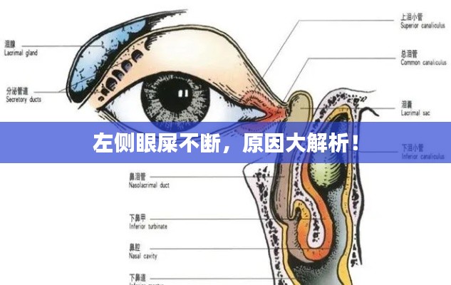 左側(cè)眼屎不斷，原因大解析！