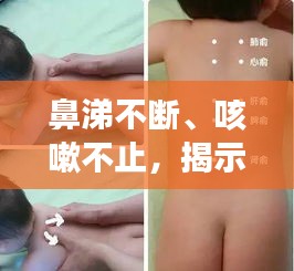 鼻涕不斷、咳嗽不止，揭示癥狀背后的健康隱患