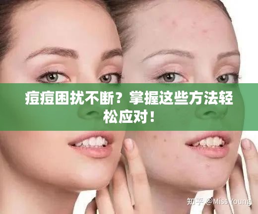 痘痘困擾不斷？掌握這些方法輕松應(yīng)對(duì)！