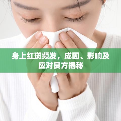 身上紅斑頻發(fā)，成因、影響及應(yīng)對(duì)良方揭秘