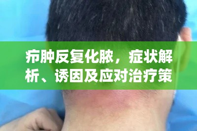 癤腫反復(fù)化膿，癥狀解析、誘因及應(yīng)對(duì)治療策略