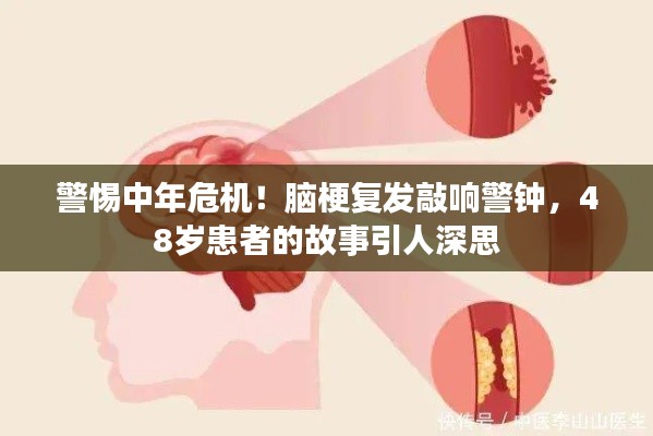 警惕中年危機(jī)！腦梗復(fù)發(fā)敲響警鐘，48歲患者的故事引人深思